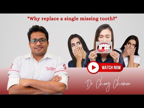 Why Replace a Single Missing Tooth?